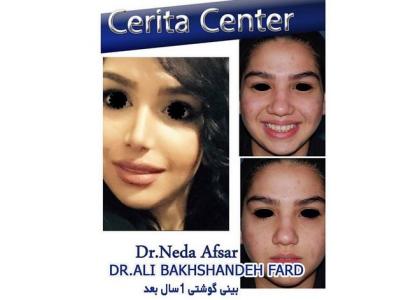COM-جراحی زیبایی بینی ، جراحی فک و ایمپلنت در تهران 