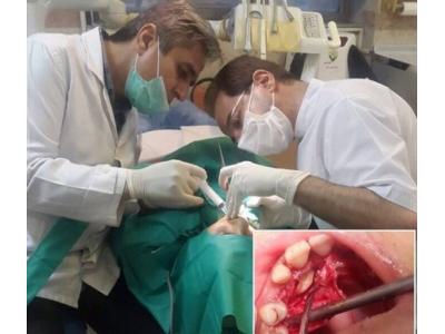 ترمیم دندان-بهترین مطب دندانپزشکی در سعادت آباد 