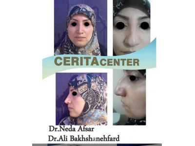 متخصص ایمپلنت-جراحی زیبایی بینی ، جراحی فک و ایمپلنت در تهران 