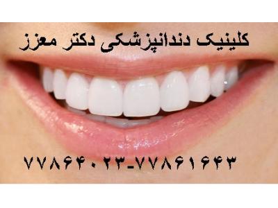جراح دندانپزشک-کلینیک دندانپزشکی دکتر محمدرضا معزز جراح ، دندانپزشک متخصص ایمپلنت در تهرانپارس