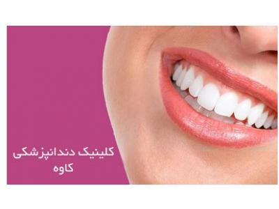 ترمیم دندان-کلینیک تخصصی دندانپزشکی در قیطریه ،  ایمپلنت و کامپوزیت ونیر