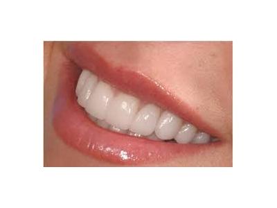 ترمیم دندان-کلینیک تخصصی داندانپزشکی در محدوده  جیحون