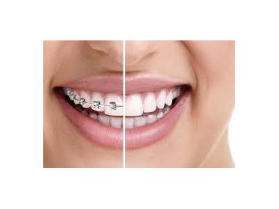 درمان ریشه دندان-کلینیک تخصصی داندانپزشکی در محدوده  جیحون