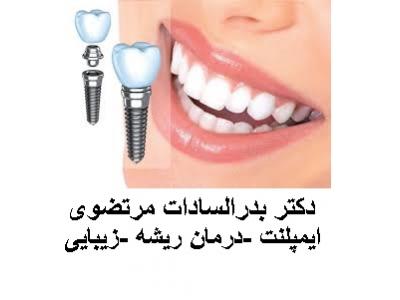 درمان ریشه دندان-کلینیک تخصصی داندانپزشکی در محدوده  جیحون