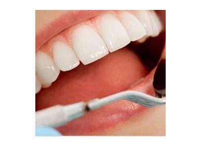 ترمیم دندان-کلینیک تخصصی ایمپلنت  و کامپوزیت ونیر مشاهیر