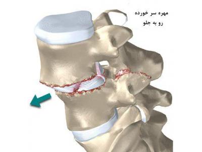 درمان سلولی   دیسک کمر و گردن  و آرتروز زانو  با لیزر سلولی در محدوده بلوار فرحزادی و غرب تهران