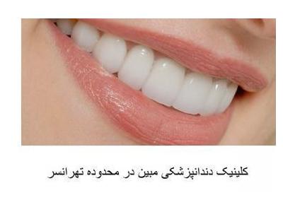 خدمات رنگ‌کاری-کلینیک تخصصی دندانپزشکی مبین در تهرانسر