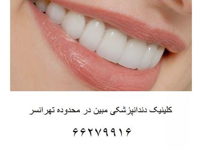 کلینیک دندانپزشکی در تهرانسر-افتتاح کلینیک دندانپزشکی مبین در محدوده تهرانسر 